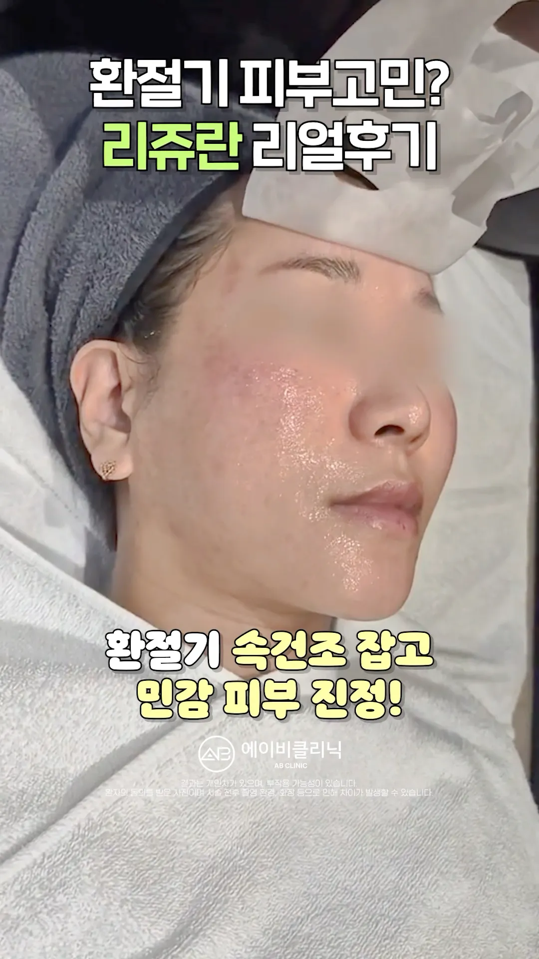 리쥬란으로 속건조 잡은 후기💯