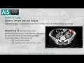Laparoscopic Sigmoidectomy in a Locally Advanced Colon Tumor