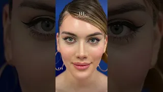 Facial Feminization Surgery