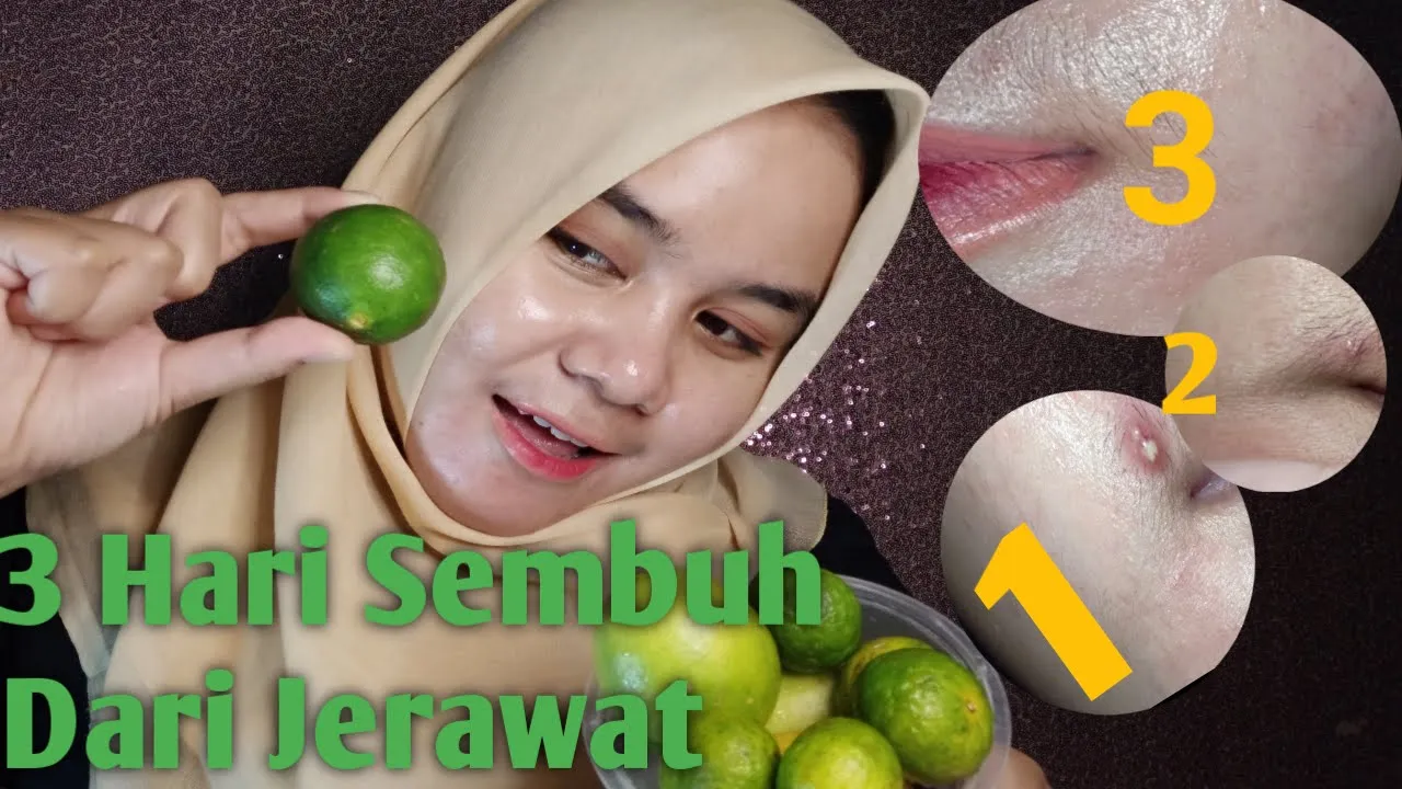 
          
          
          
            
            MENYEMBUHKAN JERAWAT DENGAN JERUK NIPIS
          
        . 