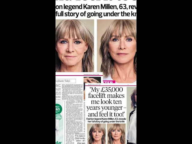 Karen Millen ve Prof. Dr. Tiryaki, The Daily Mail’de
