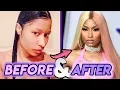 Nicki Minaj Before and After Transformations New Nose Plastic Surgery Transformation