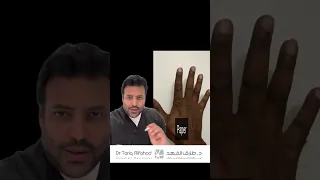 دكتور طارق الفهد و اختبار صحة اعصاب اليد الثلاث بعشر ثوان دندنها