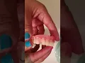 Repair it - Broken tooth