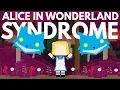 This Rare Syndrome Will Ruin Your Reality