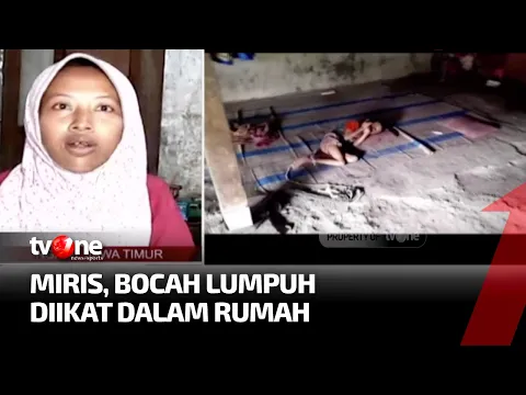 Nasib Pilu Anak Lumpuh di Ngawi yang Diikat di Tiang Rumahnya