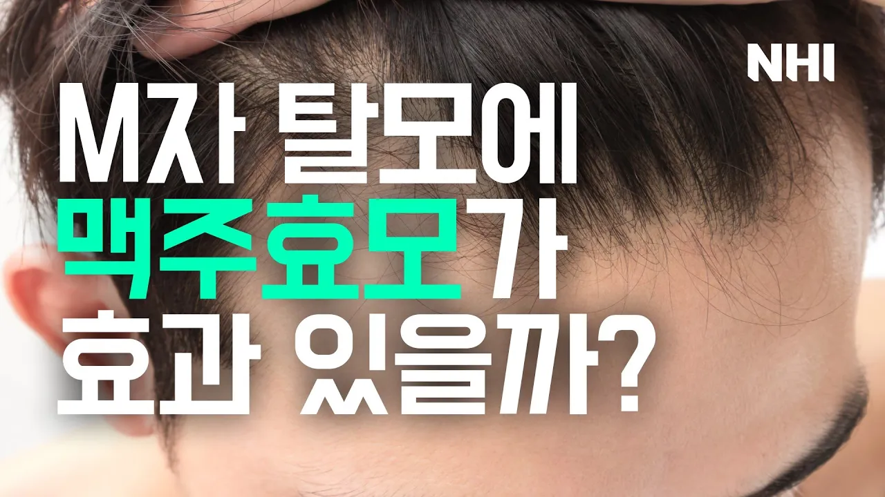 M자 탈모에 맥주효모가 정말 효과 있을까? #판시딜 #판토가 #케라민 #마이녹실ㅣ뉴헤어
