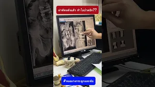 ทำไมคนที่เคยผ่าตัดหลังใส่เหล็กแล้วถึงอาจปวดหลังซ้ำได้