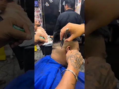 He Removed a Wart Using Just a Thread 😳 #shorts