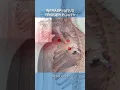 Are Infraspinatus Trigger Points Causing Your Shoulder Pain