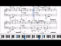 【楽譜】こたえあわせ / JUJU - ドラマ『恋です！～ヤンキー君と白杖ガール～』主題歌