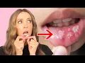 What Nicotine Pouches Do to Your Mouth