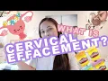 What is cervical effacement