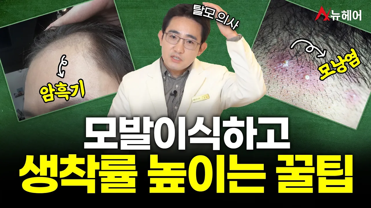 모발이식하고 일주일 지났다면 반드시 지켜야 할 것! (한 달까지 이렇게 관리하세요)