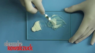 Técnica de Condensação Lateral (Obturação do Canal Radicular)