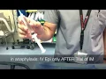 Push Dose epinephrine