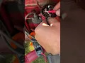 How to test a condenser on an old farmall tractor no spark at the plugs