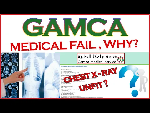 Download MP3 GAMCA Medical Report Fail  //  Why? 🤔🤔 //  ✈ Complete Details ✈