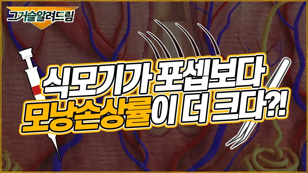 의느님답변📂ㅣ식모기가 포셉보다 모낭 손상이 더 크다? (ver.그거슬알려드림)