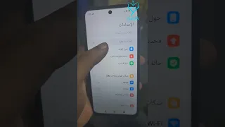                           تحديث ريدمي نوت    فورجي دندنها