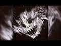 STRONDA TERRA (ORQUESTRA MALDITA)