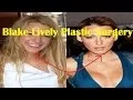 Blake Lively Plastic Surgery Before and After
