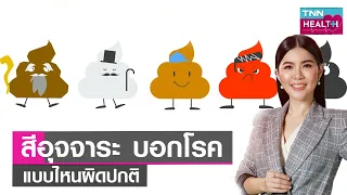 วัคซีนป้องกันไวรัสโรต้ามีกี่แบบ และให้เมื่ออายุเท่าไร