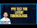 They changed tuberculosis PPD Testing LTBI for USMLE