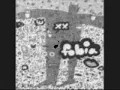 fobia - microbito