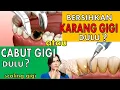 Download Lagu CABUT GIGI dulu atau bersihkan KARANG GIGI (scaling) dulu❓🤔