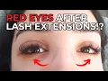 Red Eyes After Eyelash Extensions - How to Treat Prevent
