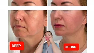 DEEP LIFTING massage Sagging Jowls Nasolabial Folds Double chin