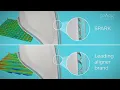 The Science Behind Spark Clear Aligners