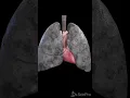 Download Lagu Stop met roken! Anatomie van de longen van een roker. #anatomie #meded #3danimation