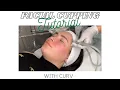 Facial Cupping Tutorial How To Perform Facial Cupping Curv Vacuum and Cupping Therapy