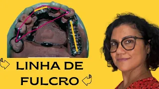 Linha de Fulcro em PPR