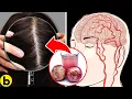 11 Ways To Increase Blood Circulation Of Scalp For Great Hair