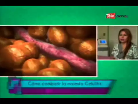 Cómo combatir la molesta celulitis