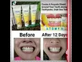 Atomy Propolis Toothpaste not just for Oral Care