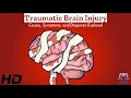 Traumatic Brain Injury Causes Symptoms Diagnosis - Navigating the Landscape