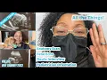 Anatomy Scan Fetal Echocardiogram and All The Things IVF Success Simply Tanika