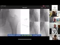 Download Lagu Trauma Case Discussion: Multi-Insitution collaboration