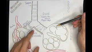 Vídeo-Esquema - Patologias Respiratórias: ASMA, DPOC, SDRA