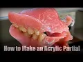 How to Make an Acrylic Partial Step-By-Step