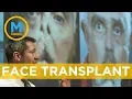 Meet the man behind Canada s first face transplant Your Morning