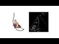 How to perform a transeosphageal echo TOE