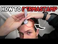 How to Derma Stamp for Quickest Hair Results Step-by-Step Guide