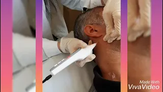 نمونه ی خال برداری 