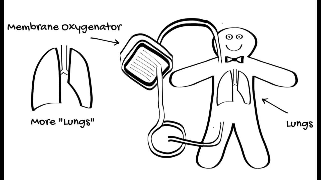 Introduction to ECMO Part 2 - V-V ECMO