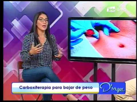 Carboxiterapia para bajar de peso